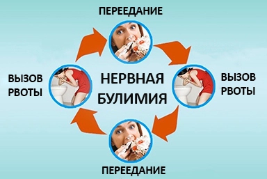 Лечение булимии в Мончегорске